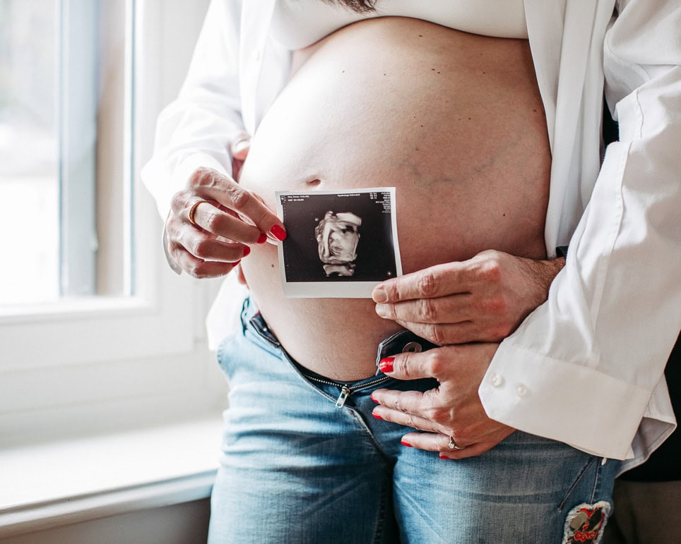 Babybauch Portrait mit Ultraschallbild in Zürich